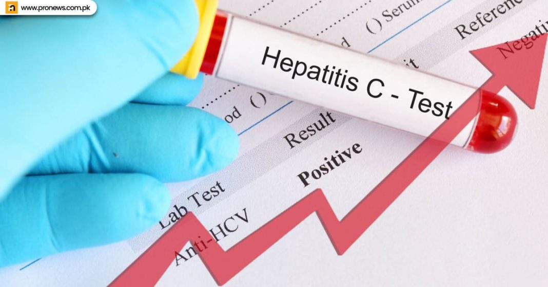 Cases of hepatitis C are rising in Sindh Health Minister