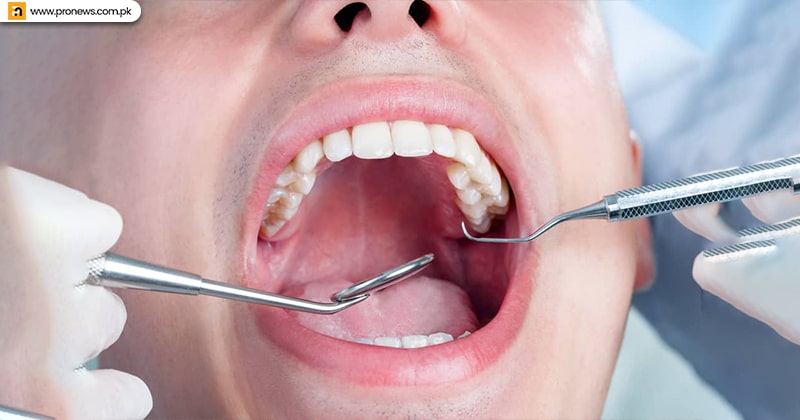 Benefits Stop Gum Disease and Tooth Decay