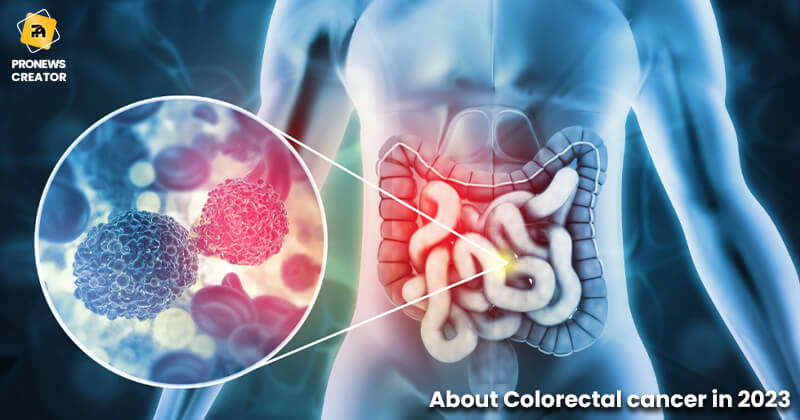 About Colorectal cancer in 2023