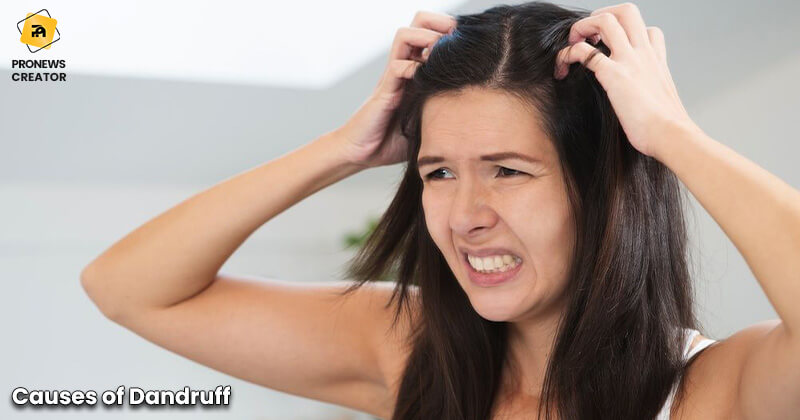 Causes of Dandruff