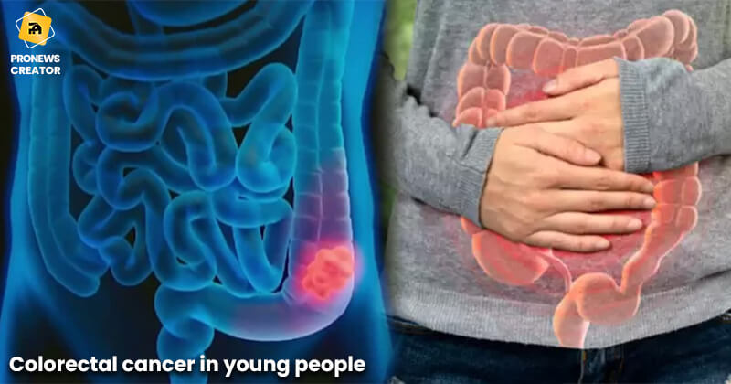 Colorectal cancer in young people