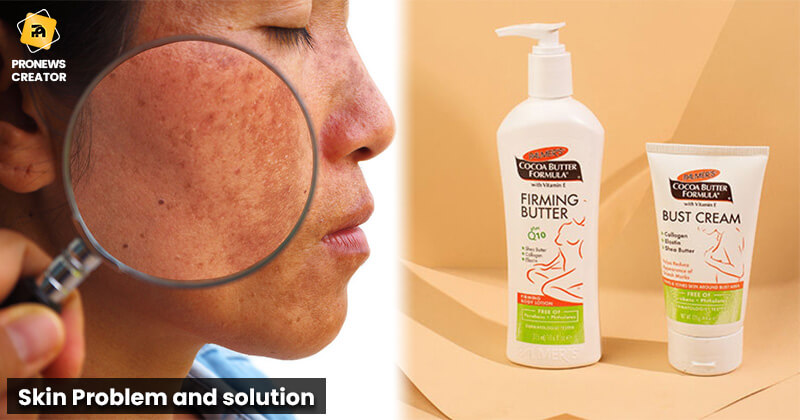 Skin Problem and solution