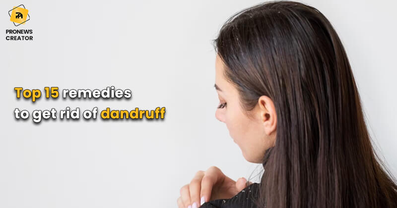 Top 15 remedies to get rid of dandruff